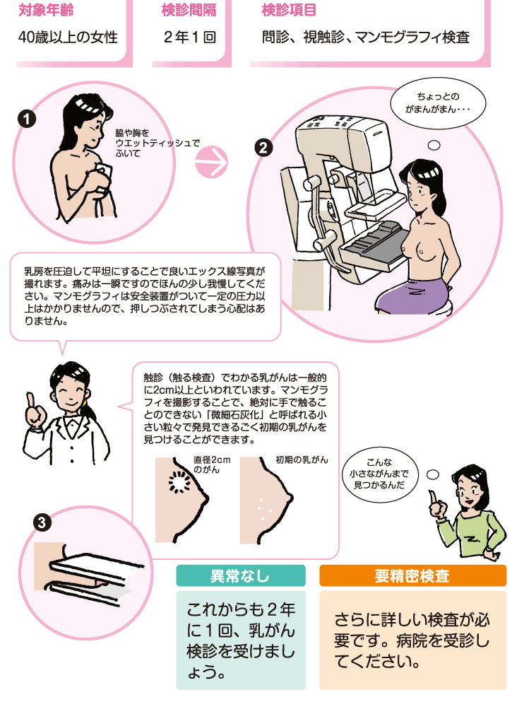 乳がん検診の流れのイラスト